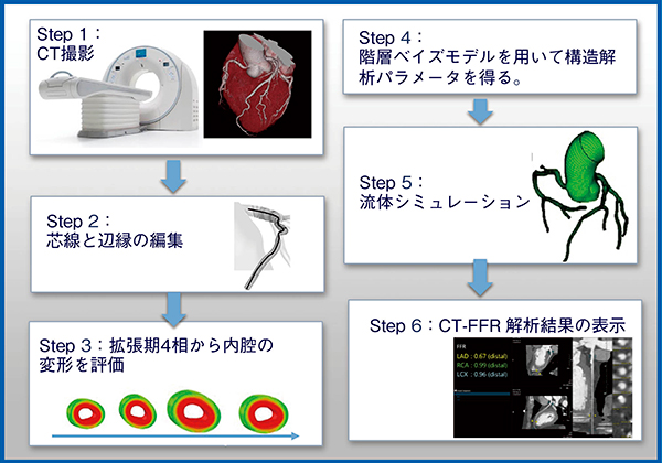 図1　CT-FFRの概要（W.I.P.）