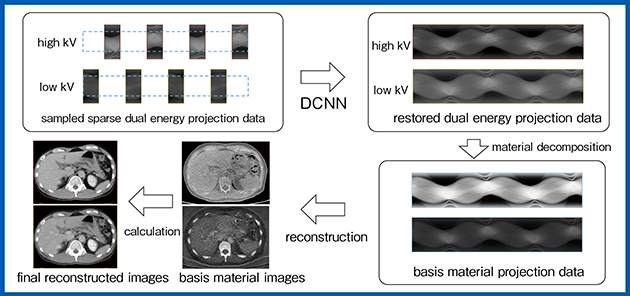 図1　DL-Spectral CTにおける画像再構成の流れ