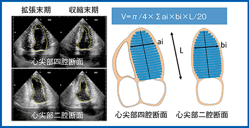 図1　Biplane disk summation法の原理