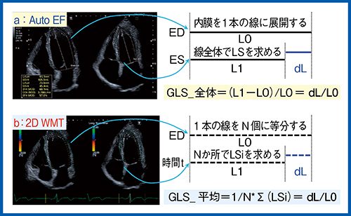 図3　Auto EFと2D WMTによるGLSの算出方法