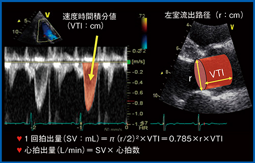 図7　ドプラ法による心拍出量の計測