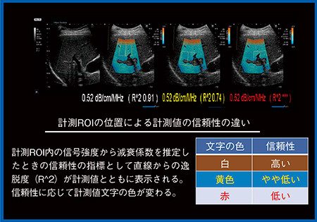 図1　ATIの計測値の信頼性