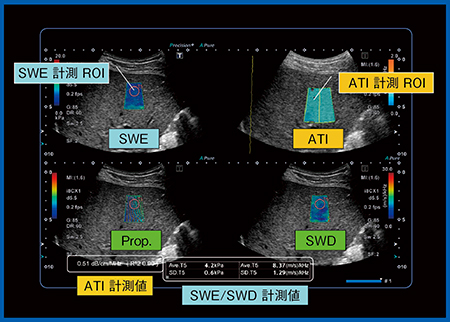 図5　Advanced SWE：Quad View