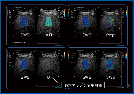 図6　Advanced SWE：Twin View