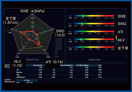 図8　Multi Parametric Report：C型慢性肝炎＋脂肪肝