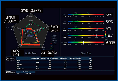 図9　Multi Parametric Report：NAFLD