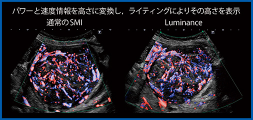 図7　Doppler Luminance