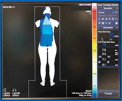 図8　Dose Tracking System