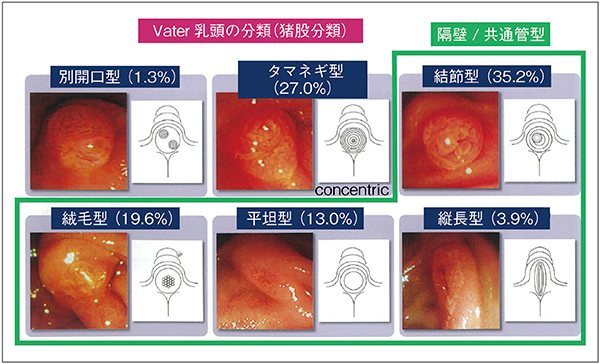 図7　乳頭の形態分類（猪股分類） （参考文献3）より転載）