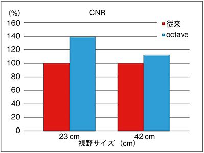 図5　透視像におけるoctaveと従来技術との濃度分解能の比較