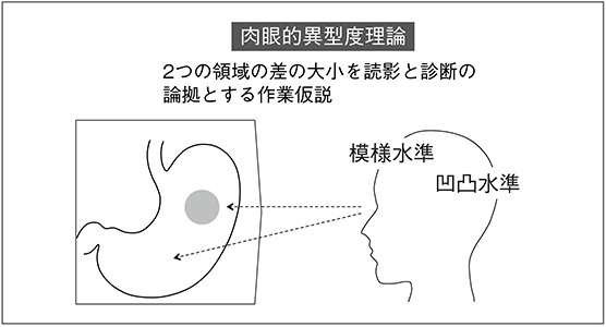 図13　正常像との形態的なかけ離れ