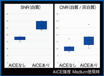 図2　1.5T装置におけるAiCEによる画質改善効果