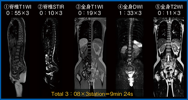 図5　全身高速MRI撮像：1.5T装置・総撮像時間10分