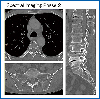 図8　症例5：骨格CT（W.I.P.）