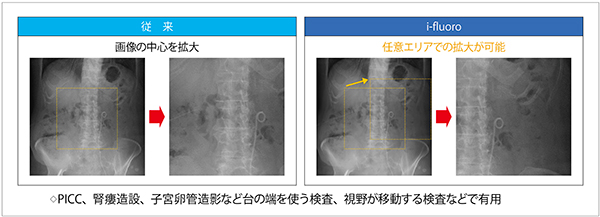 図6　i-fluoro（天板、映像系を動かすことなく、観たい部位を任意に観察可能）