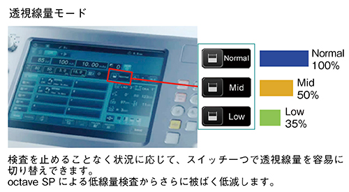 図12　透視線量モードの特長