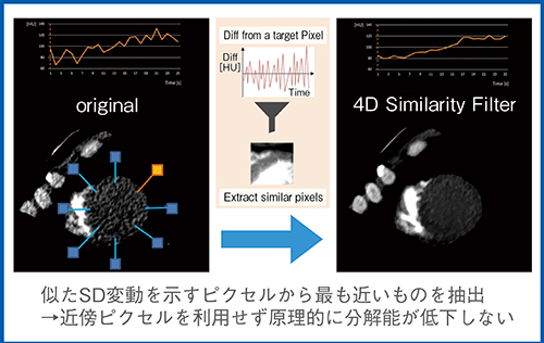 図2　4D Similarity Filterの概要