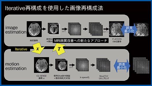 図5　CG-SENSE法を用いたmotion artifact reductionの概要