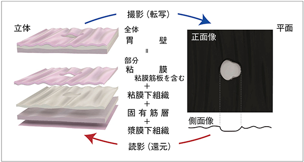 図5　平面への転写（撮影）と立体への還元（読影）