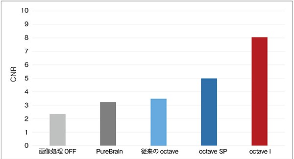 図11　octave iと従来システムの比較：透視像の濃度分解能