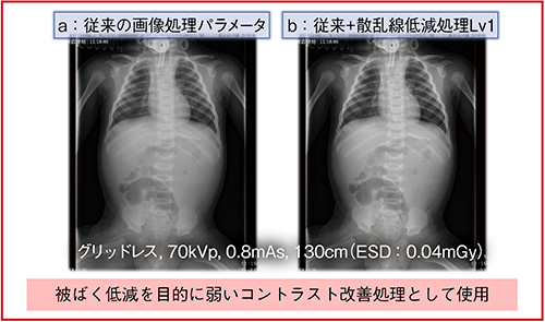 図4　乳幼児ポータブル撮影