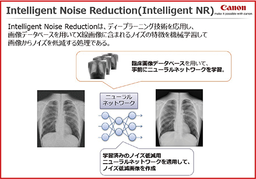 図6　Intelligent NRの概要（画像提供：キヤノン株式会社）