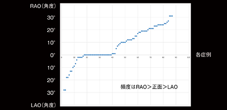 図3　当院でのCアーム回転履歴