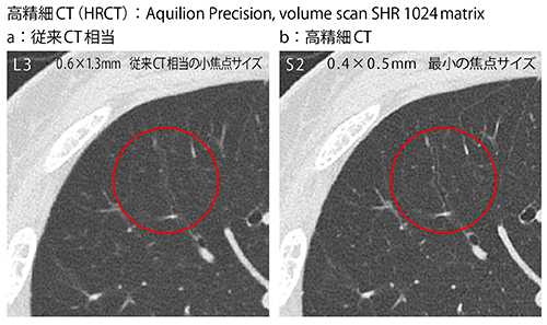 図3　従来CT相当と高精細CTにおける焦点サイズと画像の比較
