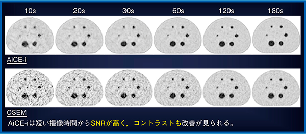 図6　撮像時間による画質変化