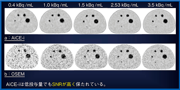 図10　投与量（放射能濃度）による画質変化