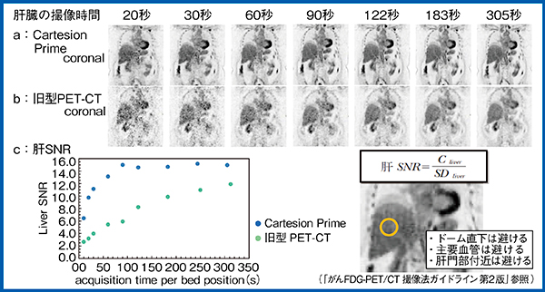 図5　Cartesion Primeと旧型PET-CTにおける肝SNRの比較（図3と同一症例）