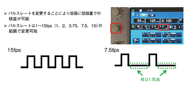 図6　Ultimax-iの低レートパルス透視の概要