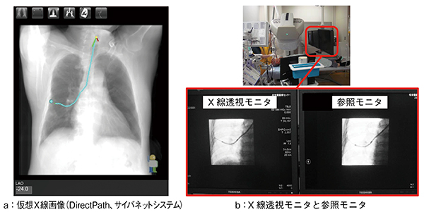 図8　仮想X線画像（ナビゲーション）の活用