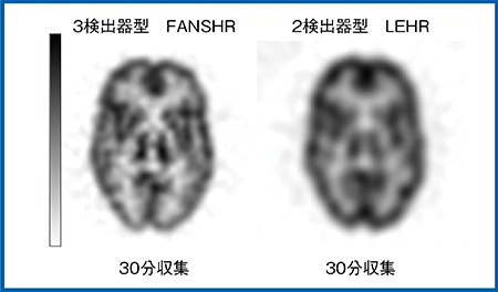 図1　3検出器型と2検出器型の比較（FBP再構成）