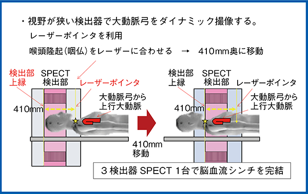 図8　GCA-9300Rでの大動脈弓部の位置合わせ