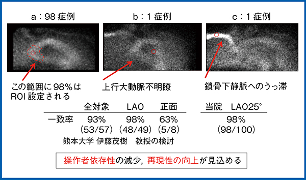 図10　当院の連続100症例における上行大動脈候補領域の一致率