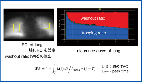 図3　肺からのWRの算出1）