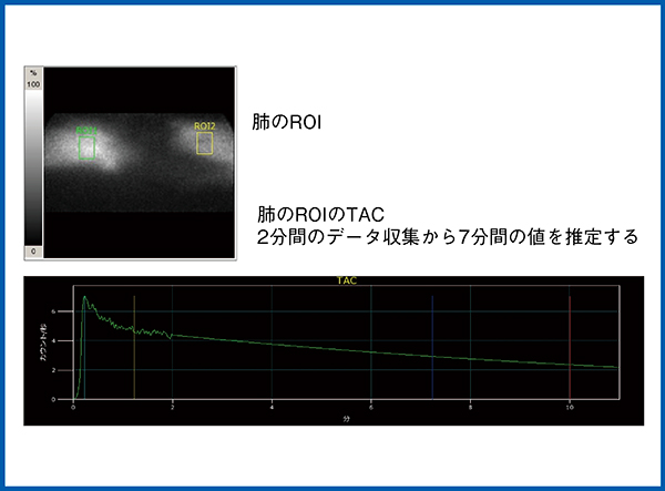 図9　データ処理：肺からのWRの推定（自験例）