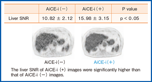 図6　肝SNRの比較