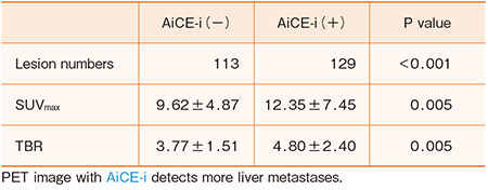 表3　肝転移における病変検出数，SUVmax，TBRの比較