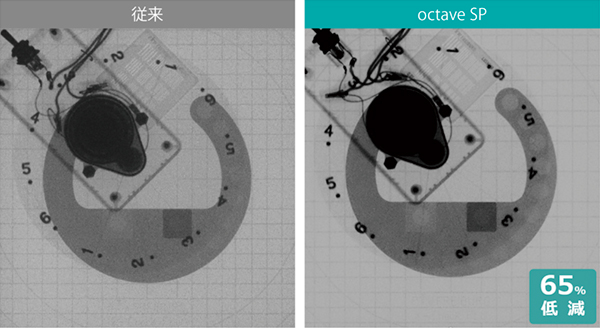 図2　高画質・低線量検査コンセプトoctave SP