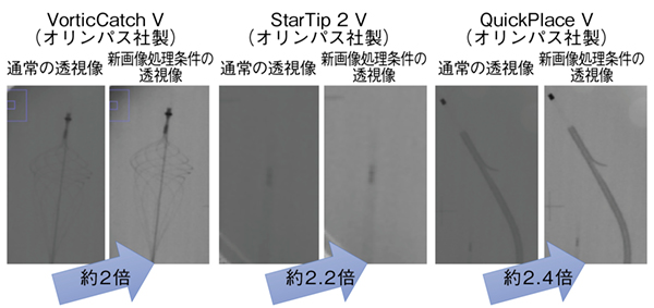 図3　通常の画像処理条件と新画像処理条件のコントラスト比較