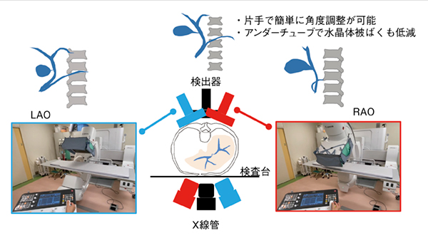 図11 　Cアームの有用性