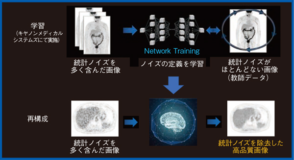 図3　Advanced intelligent Clear-IQ Engine（AiCE）の概要