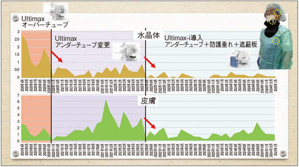 図2 当院の外部被ばく線量測定 Ultimax-i(アンダーチューブ型)と防護垂れ、遮蔽板の導入により、水晶体、皮膚ともに被ばく線量が低減した。 図2 当院の外部被ばく線量測定 Ultimax-i(アンダーチューブ型)と防護垂れ、遮蔽板の導入により、水晶体、皮膚ともに被ばく線量が低減した。