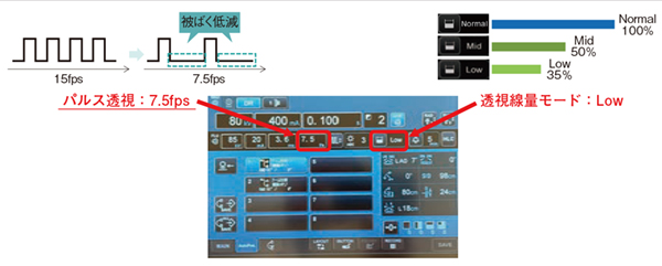 図2 帝京大学での線量率とパルスレート 9画像処理技術群(octave SP+Accent)により間接的に線量とパルスレートを抑えて、かつ確実性を担保する。 図2 帝京大学での線量率とパルスレート 9画像処理技術群(octave SP+Accent)により間接的に線量とパルスレートを抑えて、かつ確実性を担保する。