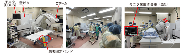 図12　当施設（神奈川県立循環器呼吸器病センター）の紹介 装置のコンパクトな奥行きと壁ピタ設置によって装置前に広いワークスペースを確保。Cアームの角度振りも活用している。