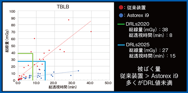 図5　装置更新前後でのTBLBのDRL値