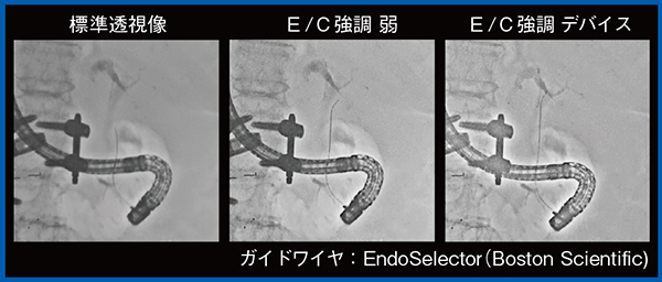 図7　ERCP（Accent適用）