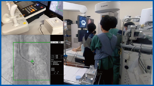 図8　i-fluoroによりモニタに干渉せず，手技を進められている。